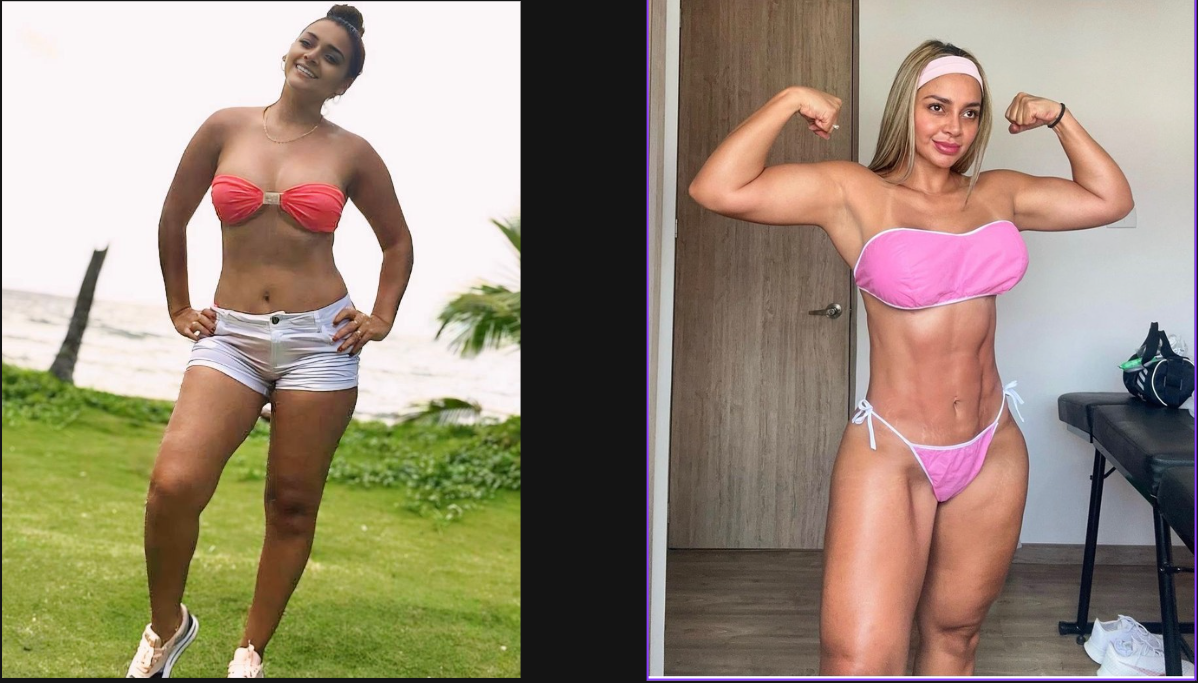 Antes y después de una cliente de VIGOR / MTZ