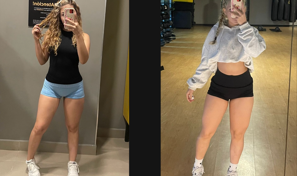 Antes y después de una cliente de VIGOR / MTZ